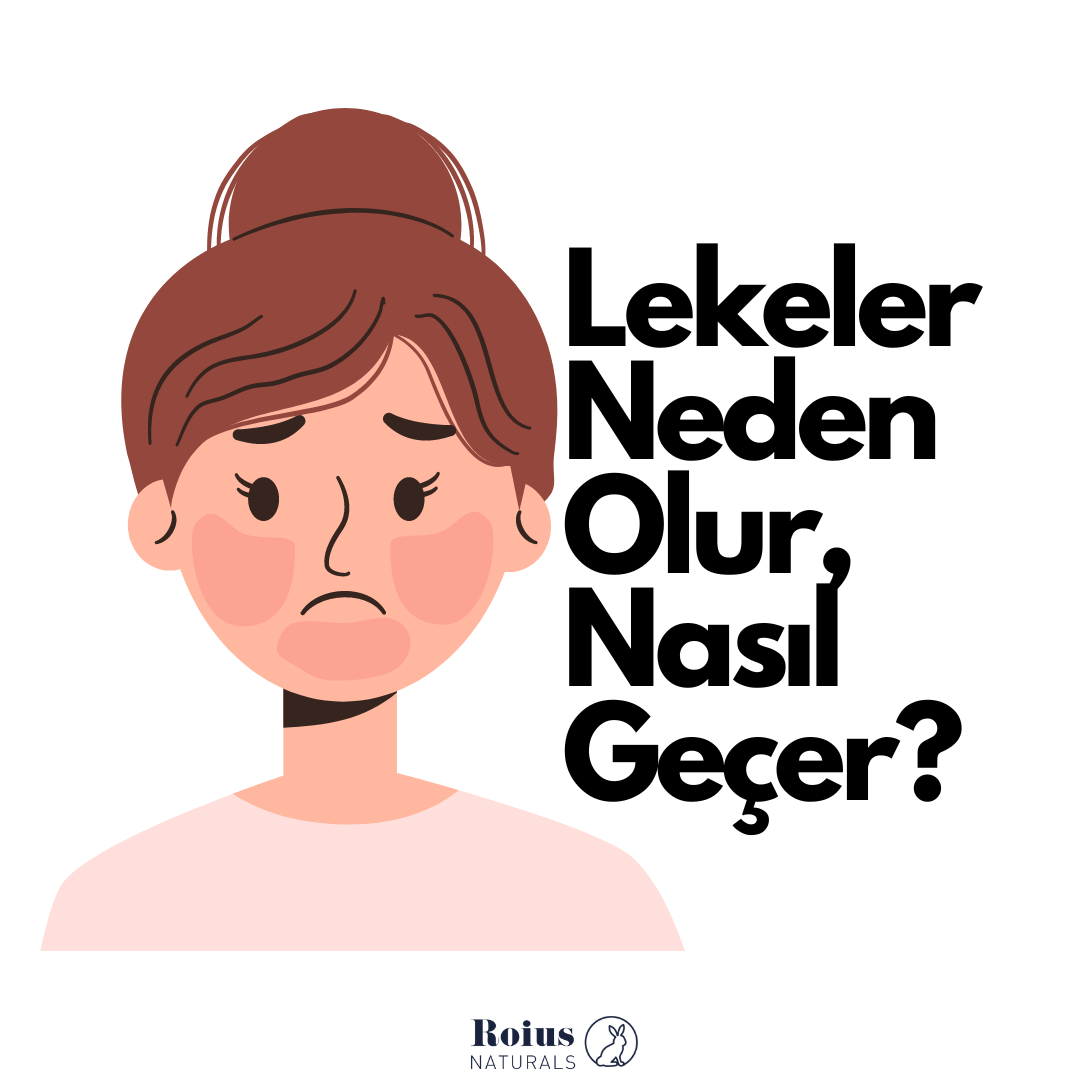 Lekeli Ciltler İçin Önerilerimiz